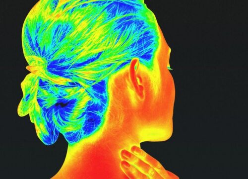 Thermography